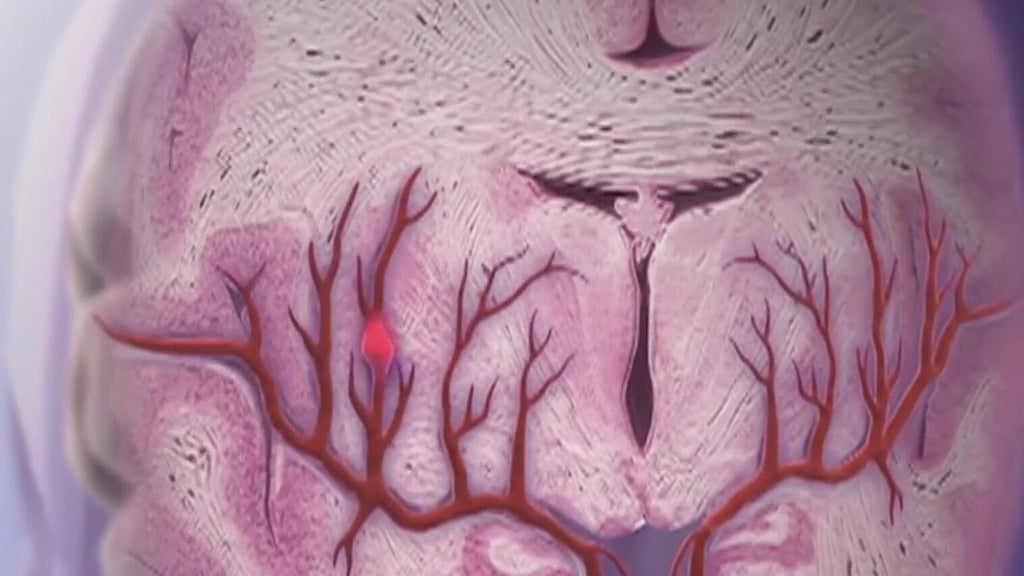 Knowing the signs of a stroke can save lives — Woodstock Community news